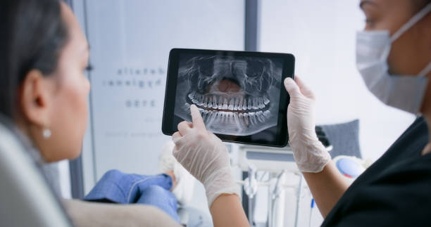 Licensed Dental Implants service in Iredell County County, NC - Smile Center Dentistry